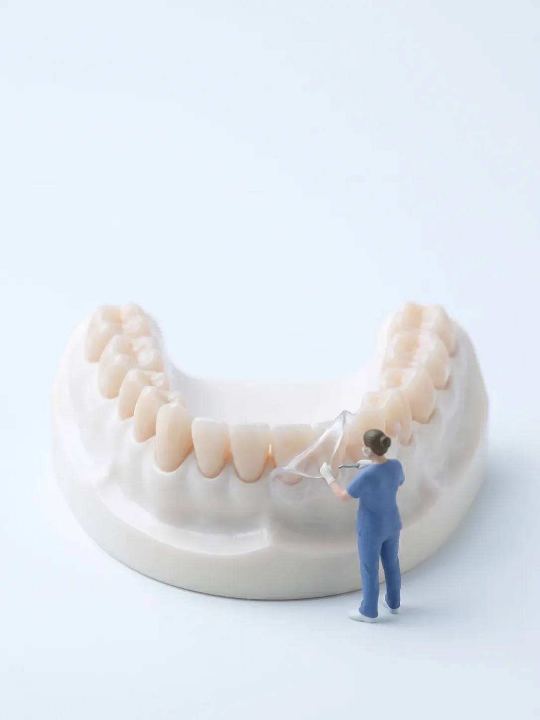 Diorama en miniatura: una figura de personal dental retira una cubeta de blanqueamiento transparente de una arcada dental gigante de tono claro y uniforme